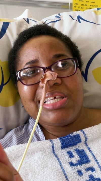 A woman lying on a hospital bed with a tube coming out of her nose