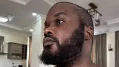 Aworan yii ṣafihan ọkunrin ọmọ orilẹede Tanzania naa, Edgar Mwakabela, ibi ori rẹ mọ ijagbọn rẹ ti ibọn ti ba a han kedere, apa ibọn naa han nisalẹ àgbọ̀n rẹ.Bakan naa lo ni irun lati oke ori rẹ wa sibi ẹnu ati gbogbo àgbọ̀n rẹ.