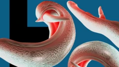 ቺስቶሶማ የተባለ ትል የሚያሳይ ባለ ሦስት አውታር ( 3ዲ) ምሥል