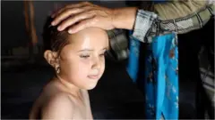 ‘අපිට කූඩාරම තුළ හුස්ම හිරවෙනවා වගේ දැනෙනවා, දරුවන් ක්ලාන්ත වෙනවා'