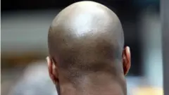 Watu wengine wanaamini kwamba vichwa vya watu wenye upara vina dhahabu nchini Mozambique