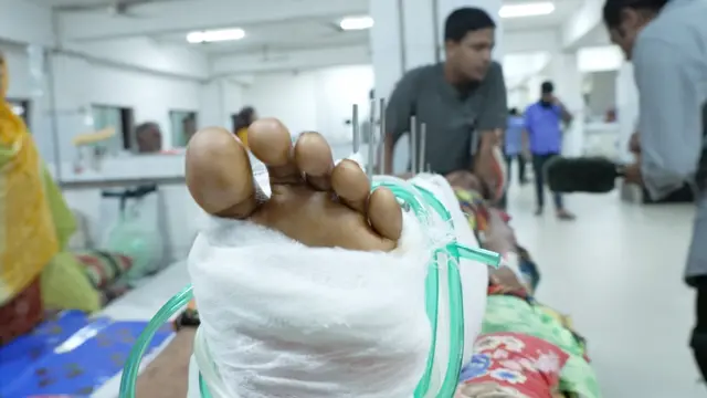 পঙ্গু হাসপাতালে চিকিৎসা নেয়া ২৭২ জনের মধ্যে ২৪৫ জনই গুলিতে আহত