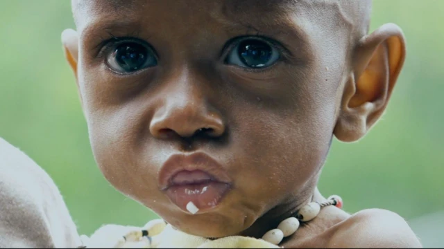 Papua, gizi buruk, Asmat