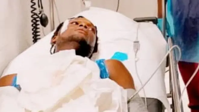 Un homme blessé lors de la fusillade au péage de Lekki - Lagos, Nigéria