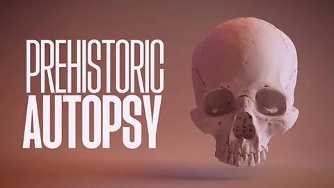 Prehistoric Autopsy