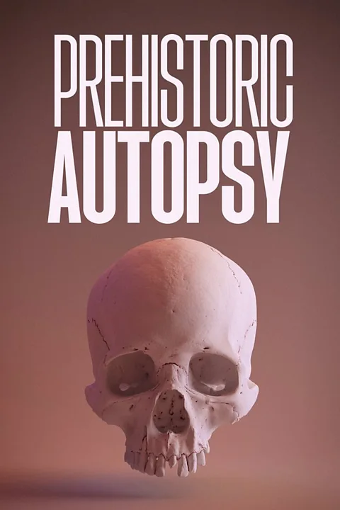 Prehistoric Autopsy
