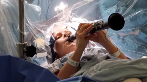 A woman plays the clarinet while undergoing brain surgery